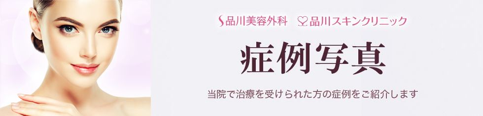 症例写真
